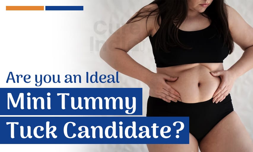 How to Know if I am an Ideal Mini Tummy Tuck Candidate